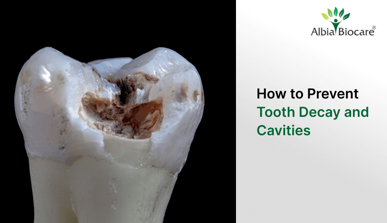 How to Prevent Tooth Decay and Cavities