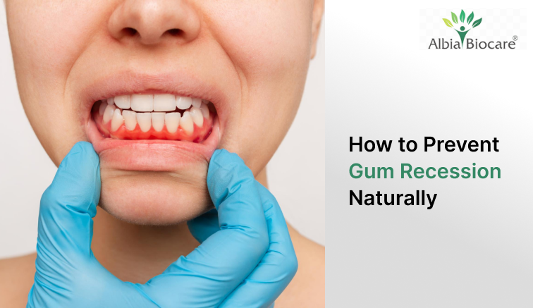 How to Prevent Gum Recession Naturally
